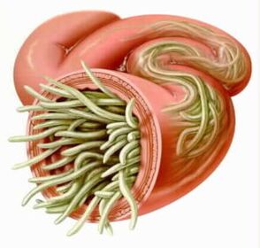 Parásitos en el intestino