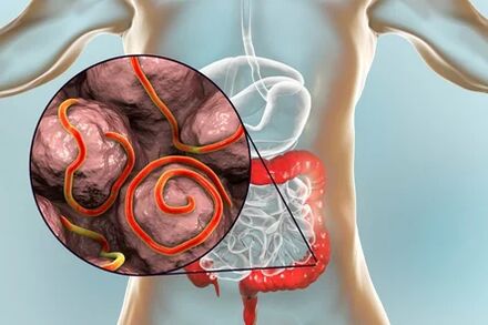 Parásitos en el intestino