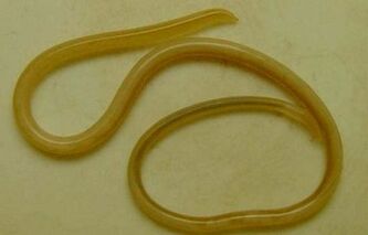 Tipos de parásitos en el cuerpo humano.