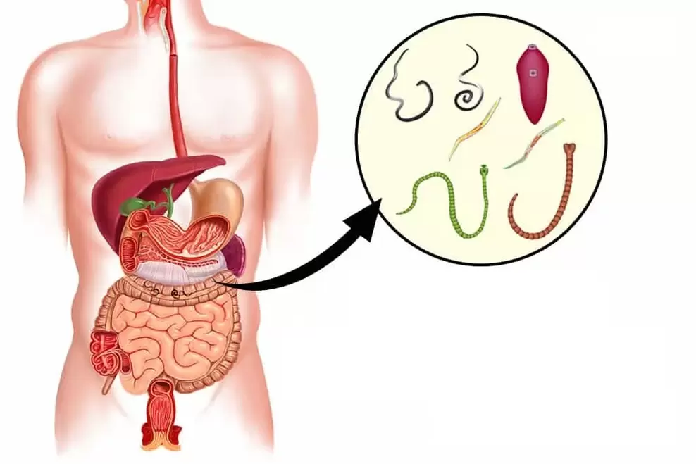 Gusanos en el cuerpo humano.