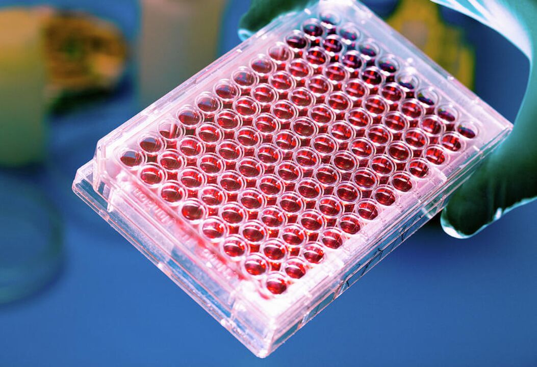Análisis de sangre para parásitos.