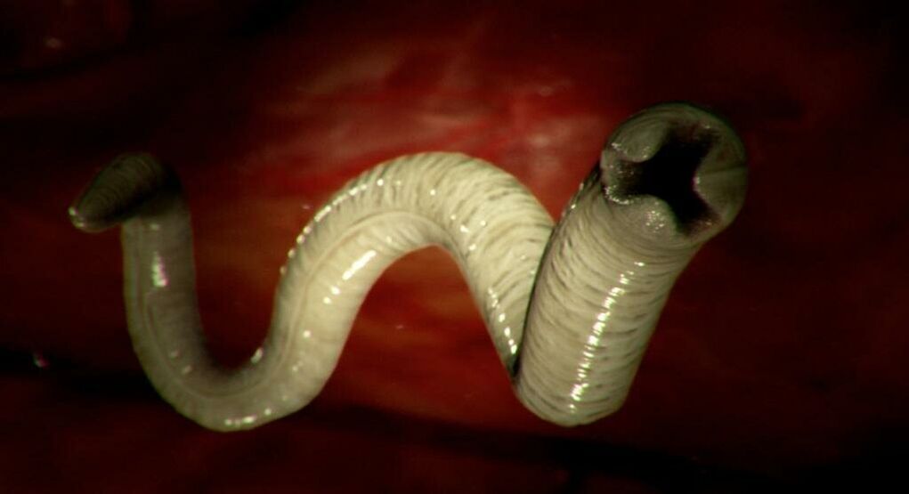 Gusano del cuerpo humano.
