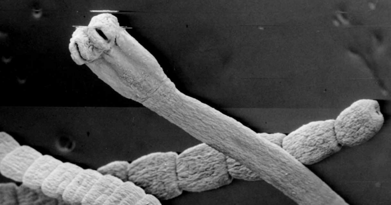 Gusanos del cuerpo humano.